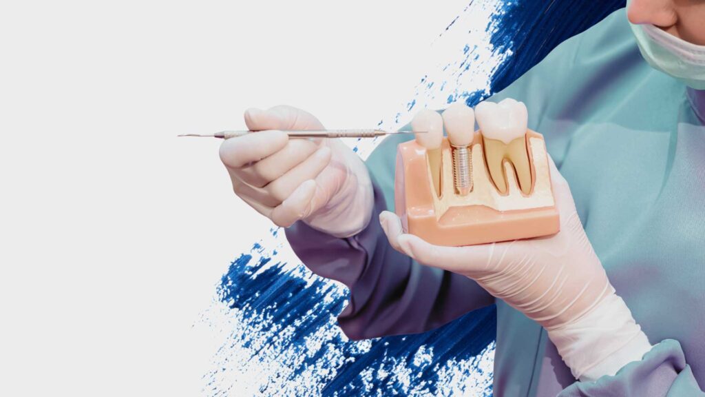 The Economic Impact of Dental Implants on a General Dental Practice